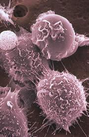 bone marrow stem cells